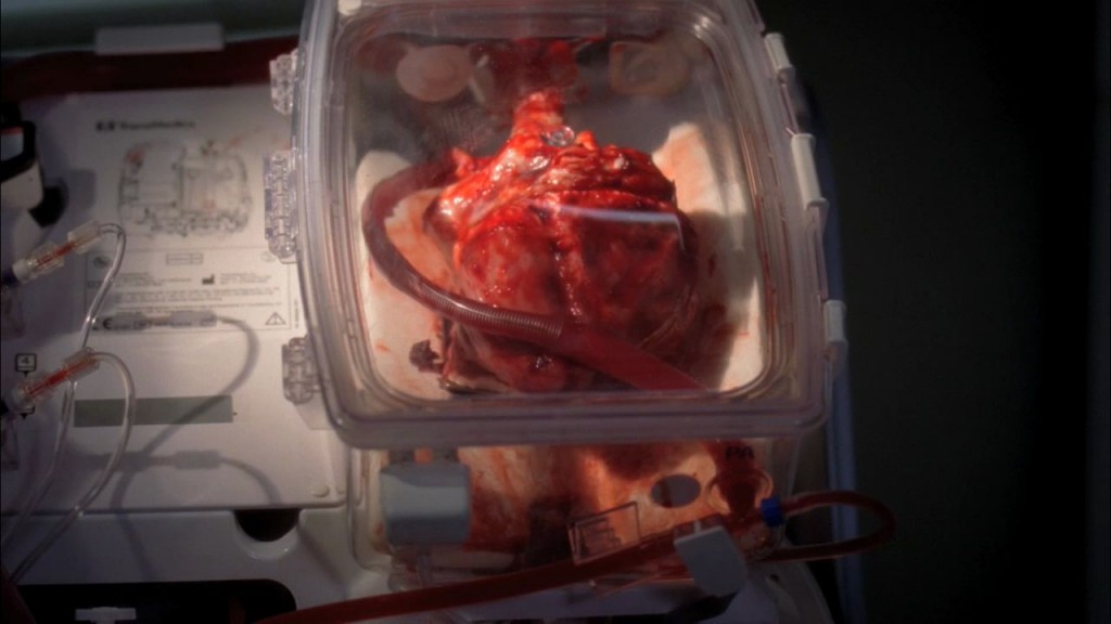 grey's anatomy organs